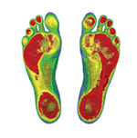 footscan