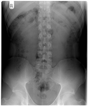 x ray